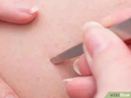 Image titled Prevent Ingrown Hairs on Your Legs Step 12