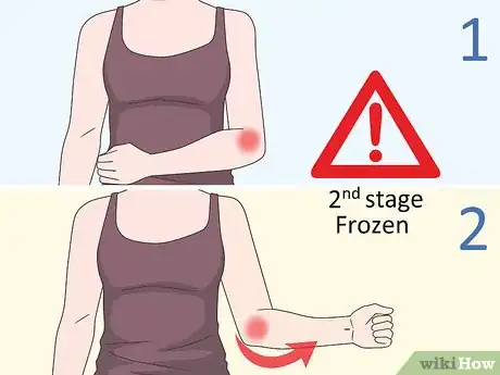 Image titled Diagnose a Frozen Shoulder Step 2