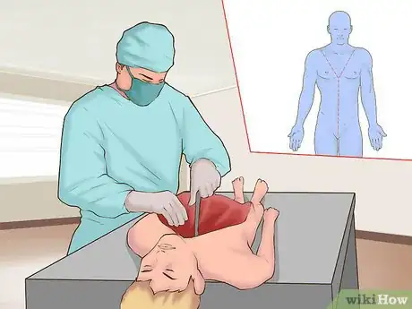 Image titled Perform an Autopsy on a Human Being Step 8