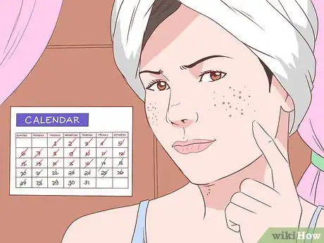 Image titled Get Rid of Acne Without Using Medication Step 36