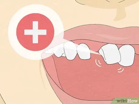 Image titled Pull a Loose Tooth at Home Step 16