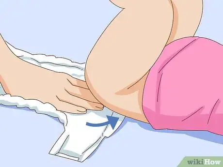 Image titled Change a Disposable Bedwetting Diaper Step 10