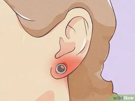 Image titled Gauge Your Ears Step 15