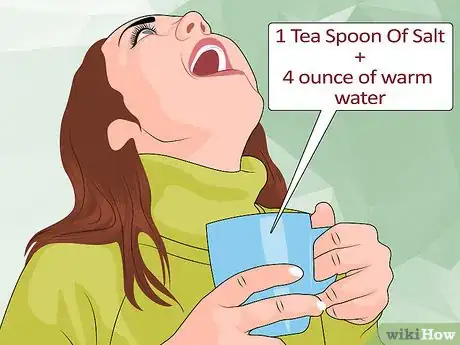 Image titled Avoid Getting Canker Sores Step 8