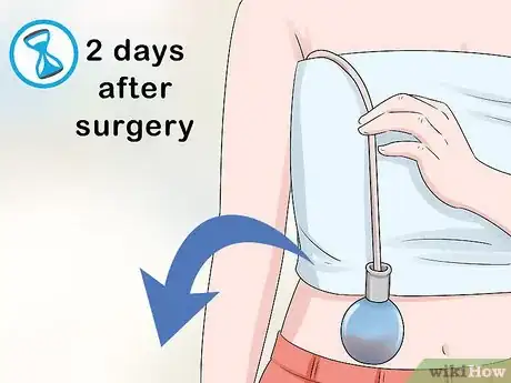 Image titled Reduce Drainage After a Mastectomy Step 5