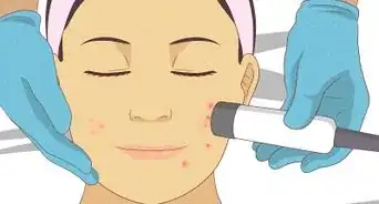 Get Rid of a Hard Pimple