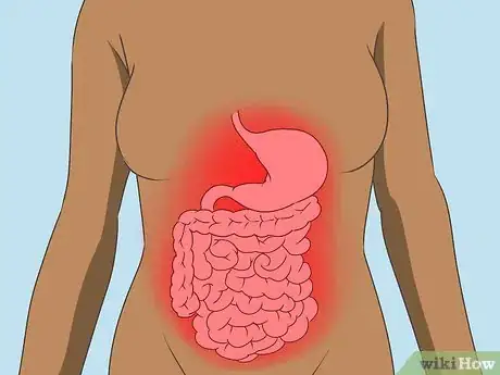 Image titled Treat Diverticulitis Step 10