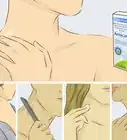 Give Someone a Hickey