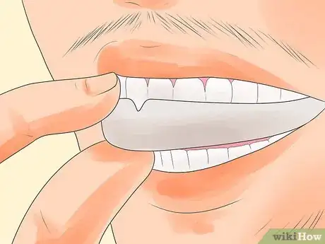 Image titled Cure Bruxism Step 13