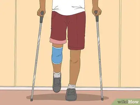 Image titled Heal After ACL Surgery Step 4