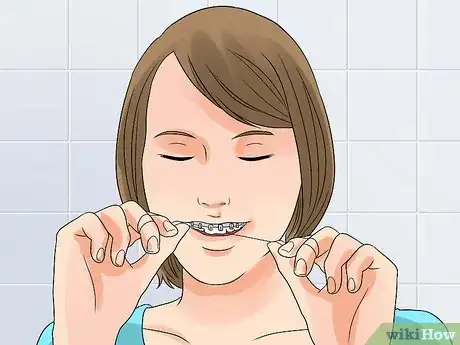 Image titled Whiten Your Teeth when You Have Braces Step 3