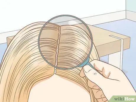 Image titled Recognize Head Lice Step 3