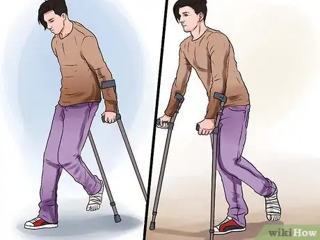 Image titled Walk on Crutches Step 16