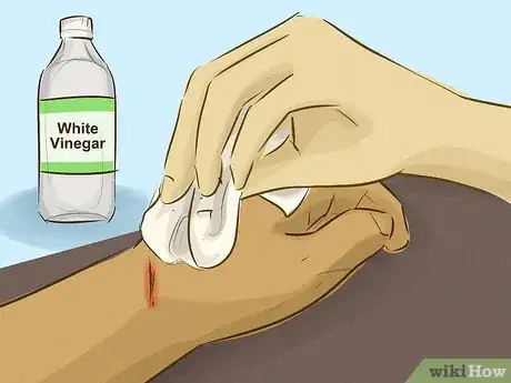 Image titled Stop Bleeding Step 3