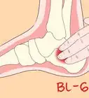 Use Acupressure Points for Foot Pain