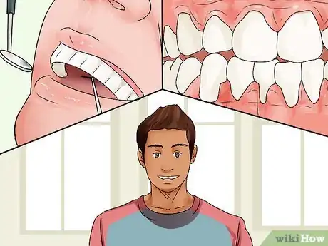 Image titled Get Healthy Gums Step 11