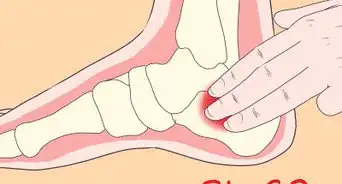 Use Acupressure Points for Foot Pain