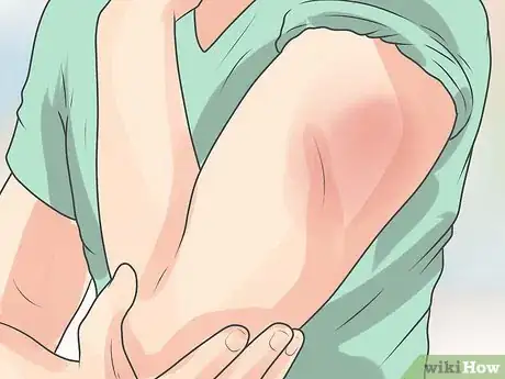 Image titled Manage a Painful Injection Step 9