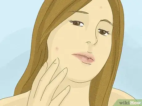 Image titled Stop Picking at Acne Step 7