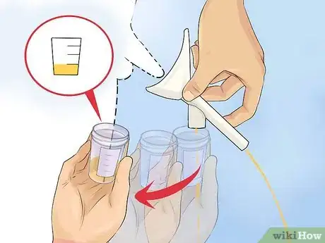 Image titled Help a Male Child Provide a Urine Sample Step 14