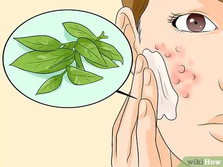 Image titled Use Herbal Remedies for Rosacea Step 6