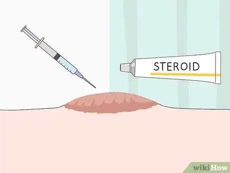 Image titled Get Rid of Back Acne Scars Step 15