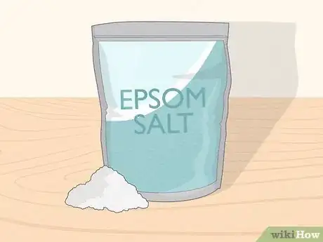 Image titled Remove a Wart Using Epsom Salts or Daffodils Step 1