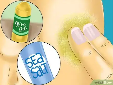 Image titled Use Olive Oil to Remove Scars Step 6