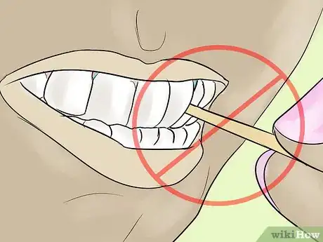 Image titled Eat With Separators in Your Mouth Step 5