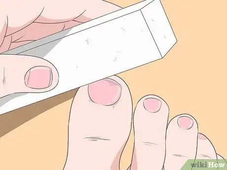 Image titled Fix Thick Toenails Step 10