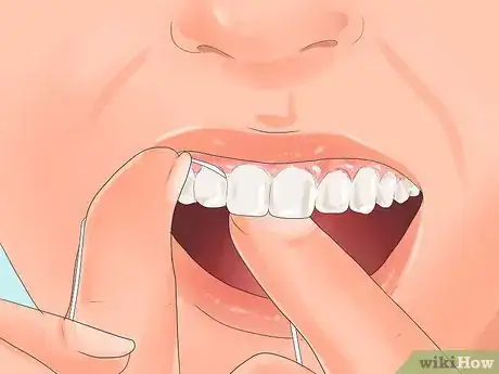 Image titled Get Pink Gums Step 9