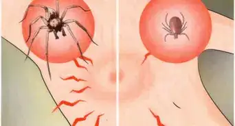 Identify a Spider Bite