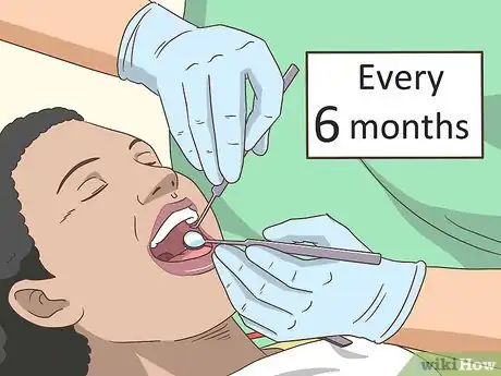 Image titled Prevent Receding Gums Step 1