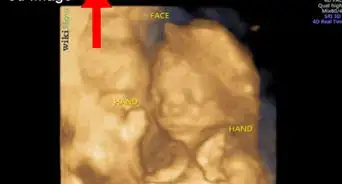 Read an Ultrasound Picture