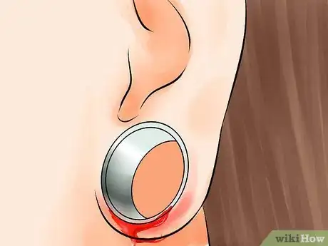 Image titled Gauge Your Ears Without Getting a Blowout Step 9