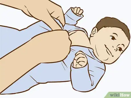 Image titled Treat Neck Rashes for Your Baby Step 9