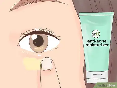 Image titled Remove Clogged Pores Under Your Eyes Step 7
