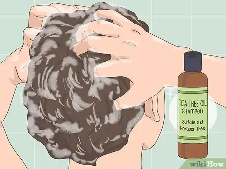 Image titled Get Rid of Dandruff Step 7