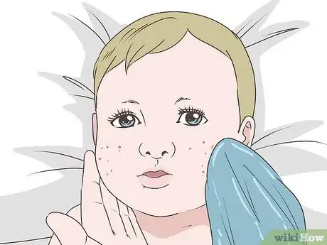 Image titled Get Rid of Baby Acne Step 2