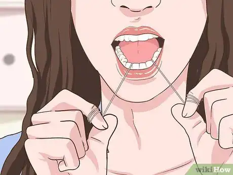 Image titled Prevent Tonsil Stones Step 2