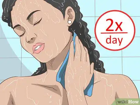 Image titled Get Rid of Neck Acne Step 1