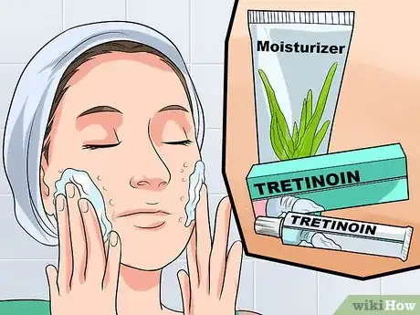 Image titled Use Tretinoin and Benzoyl Peroxide Concurrently Step 4