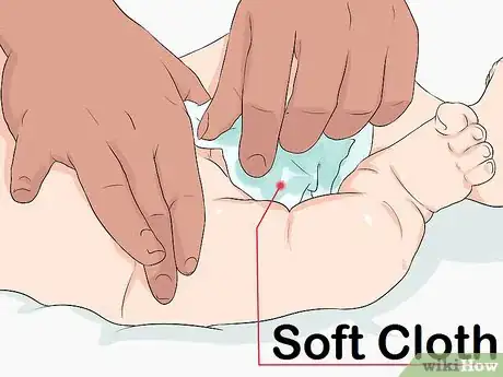 Image titled Clean a Circumcision Step 1