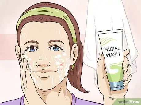 Image titled Painlessly Pop a Pimple Step 13