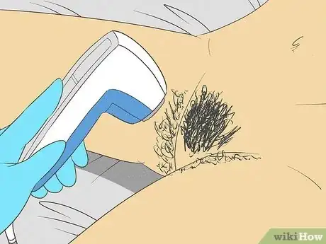 Image titled Prevent Ingrown Hairs on the Pubic Area Step 10