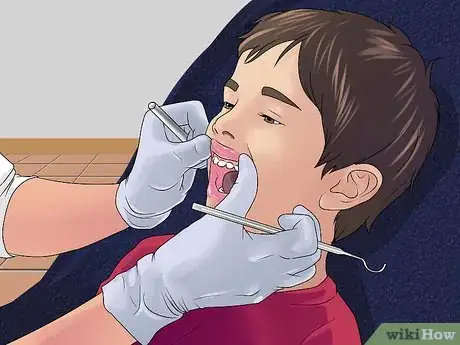 Image titled Stop the Bleeding After You Pull out a Loose Tooth Step 7