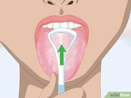 Image titled Clean the Back of Your Tongue Step 8