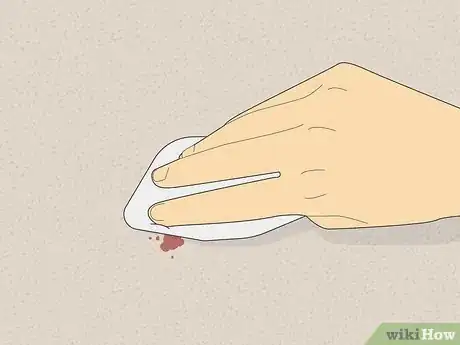 Image titled Remove Blood Stains from Carpet Step 1