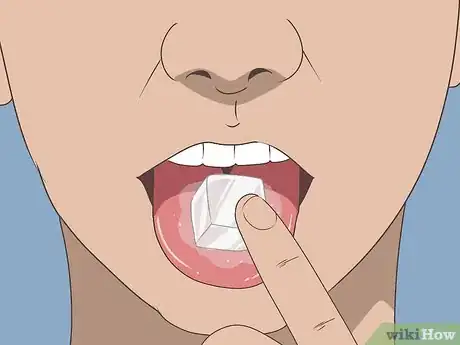 Image titled Soothe Inflamed Taste Buds Step 1