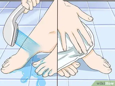 Image titled Remove Stains from Your Feet Step 13